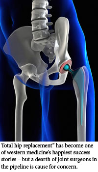 Picture of hip bones